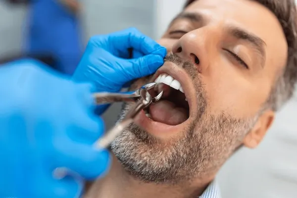 Urgence dentaire à Agadir : rage de dent, abcès, dent cassée… que faire ?